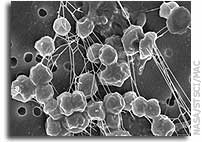 Mars May Be A Cozy Place for Hardy Microbes