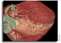NASA Image Fusion Will Help Doctors Examine Astronauts’ Hearts in Space